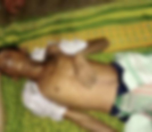 বজ্রাঘাতে মৃত্যু নবম শ্রেণির ছাত্রের।